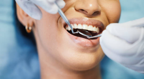 Best Emergency Treatment for Dental Infections or Abscesses in Thompson Falls, MT