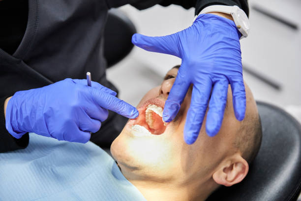 Best Emergency Dental Care for Broken or Chipped Teeth in Thompson Falls, MT